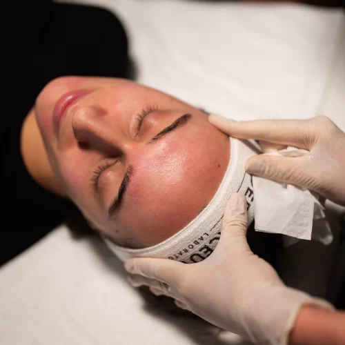 Formation peeling médecin